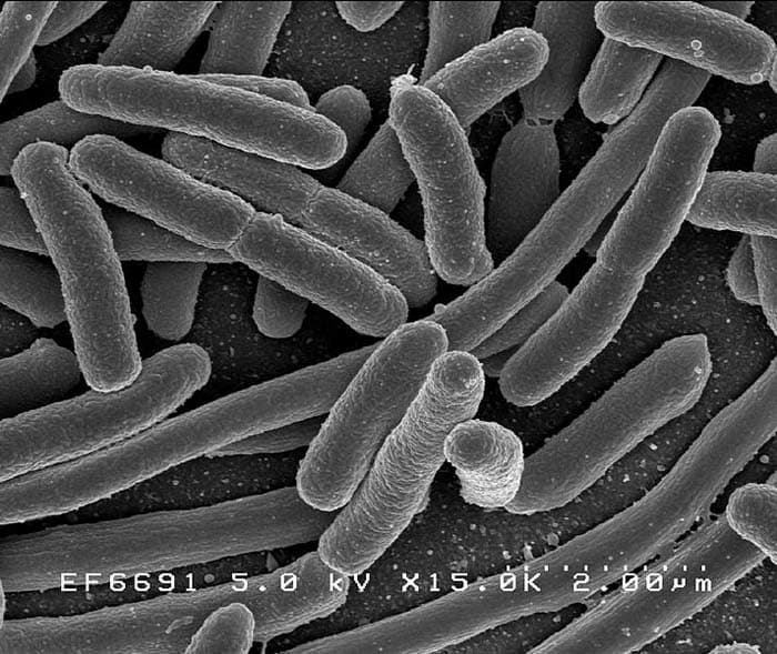 Salmonella is a type of bacteria that infects over 140,000 Americans each year
