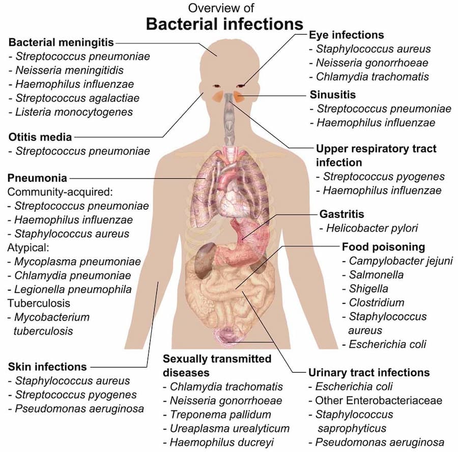 There are many different types of bacterial infections