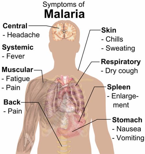 Malaria has many alarming symptoms, and may cause death if one does not seek medical advice
